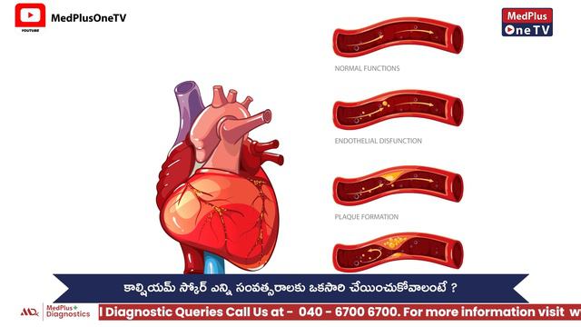 Calcium Score Test |Coronary Calcium Score Test for Heart Risk |Dr.Sreeni R Gangasani @MedPlusONETV смотреть онлайн