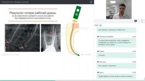 Вебинар "Эндодонтия. Базовые знания" Дмитрия Николаева