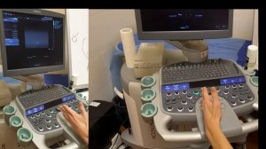 Методика ультразвукового исследования  карпального канала, срединного нерва при туннельном синдроме