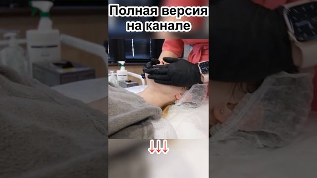 Миндальный пилинг Shorts