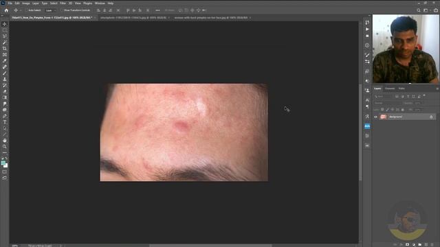 Heal Skin and Fix Flaws using AI in Photoshop смотреть онлайн