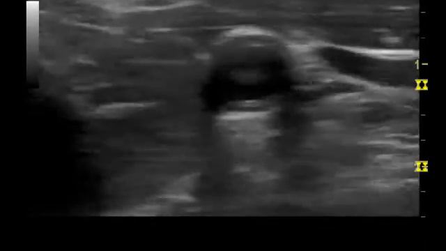 ОСА2 смотреть онлайн