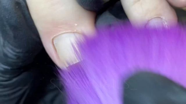 Обработка сложных пальцев с разросшимся птеригием. смотреть онлайн