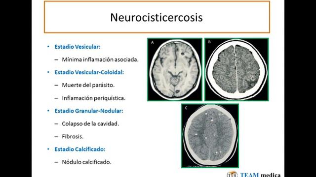 Tmmed infectología - 2 3 смотреть онлайн