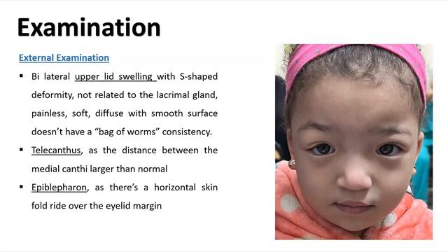 CUPS Pediatric Oculoplastics Meetings смотреть онлайн