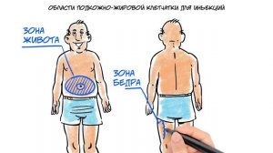 Как правильно делать инъекцию инсулина при сахарном диабете.