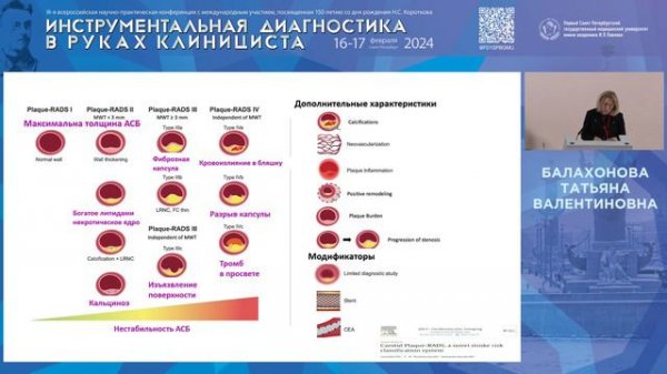 Новая система стратификации риска инсульта - возможности Plaque-RADS