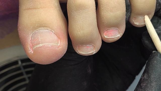 КАК ПРАВИЛЬНО ПОДСТРИГАТЬ НОГТИ. ПЕДИКЮР ОДНОЙ ФРЕЗОЙ. Переделываю домашний педикюр.Pedicure. смотреть онлайн