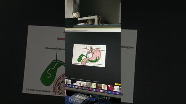 Рефлюкс заброс кислоты в желудок смотреть онлайн