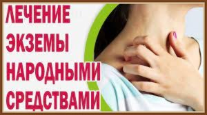 ЛЕЧЕНИЕ ЭКЗЕМЫ НАРОДНЫМИ СРЕДСТВАМИ