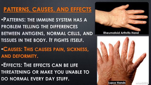 Fighting Lupus and Rheumatoid Arthritis смотреть онлайн