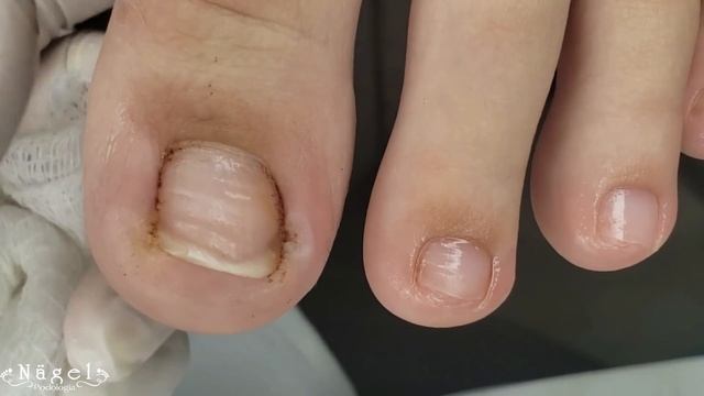 CORTAR REDONDO OU QUADRADO?