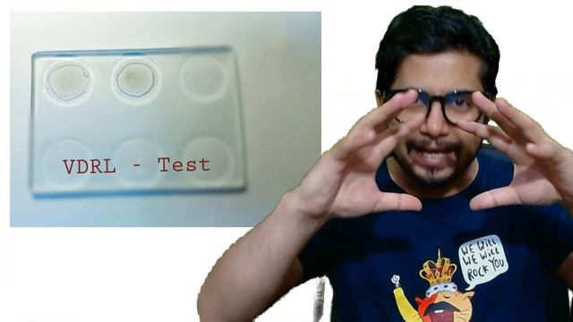 VDRL Test Hindi | VDRL Test Kya Hota Hai?