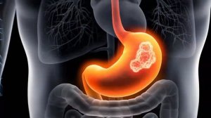 Всего одна ложка льняного масла в день и организм не узнать | Льняное масло польза и вред