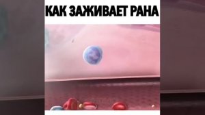 КАК ЗАЖИВАЕТ РАНА