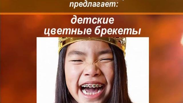 Брекеты: установка, корректировка в стоматологическом центре "Тикомед", Минск смотреть онлайн