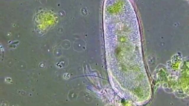 Инфузория туфелька Paramecium caudatum смотреть онлайн