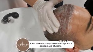 Первое мытье головы после пересадки волос (Russian)