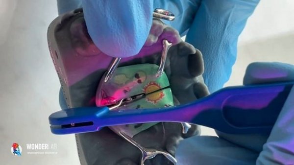 Активация аппарата Марко Росса