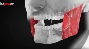 Тренировки с bcjawer тренажером - эспандером для скул, овала лица и подбородка.