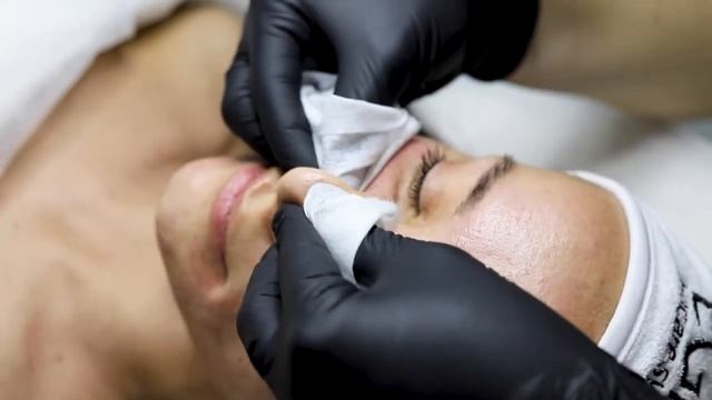 Атравматическая чистка лица смотреть онлайн