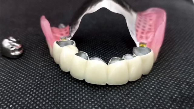 СЪЕМНЫЕ ПРОТЕЗЫ!!! Не доводите дело до этого!!! Техник: БАКИРОВ МУСА…#ярославль#стоматология#master смотреть онлайн