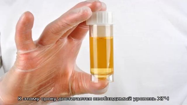 Когда делать тест на беременность? смотреть онлайн