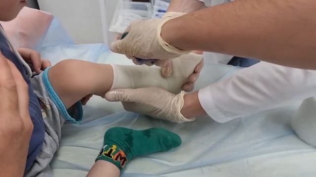 СЕРЁЖЕ ПОМЕНЯЛИ ГИПС НА ПОЛИМЕРНЫЙ | ОТИТ И РАСЩЕЛИНА НЁБА смотреть онлайн