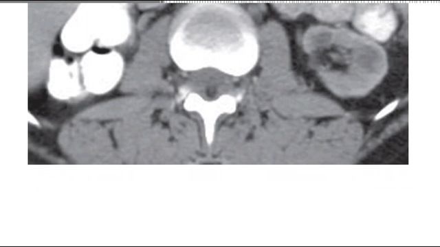 MC GRAW HILL GIT RADIOLOGY BOOKS FRCR(1) смотреть онлайн