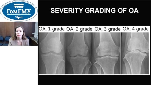 Yarmolenka V. Osteoarthritis. Gout смотреть онлайн