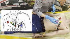 Методика регистрации ЭКГ