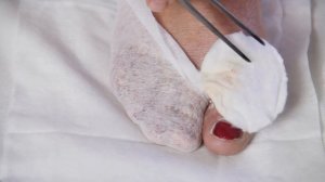 Вскрываю ужасный гнойник дома