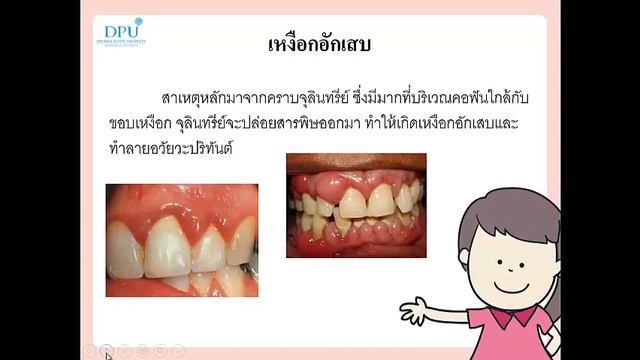 แกนนำนักเรียนทันตสุขภาพ โดยนางสาวนิซง ยายอ 136070030 смотреть онлайн