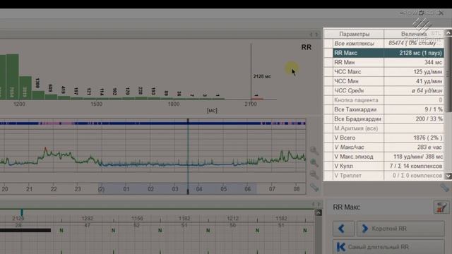Как Работать с BTL CardioPoint Holter смотреть онлайн