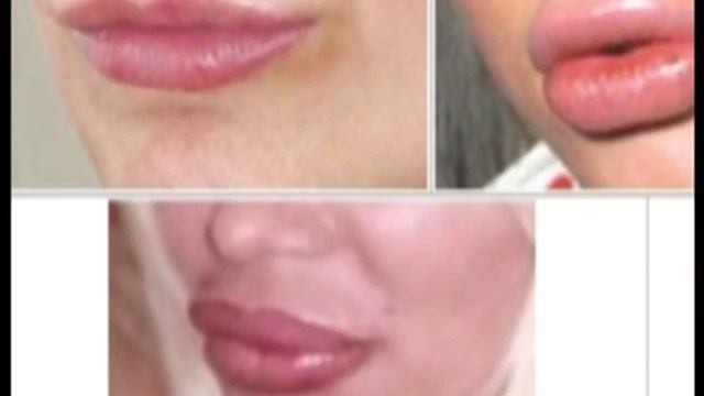 Час Порад - "+" и "-" увеличения губ смотреть онлайн