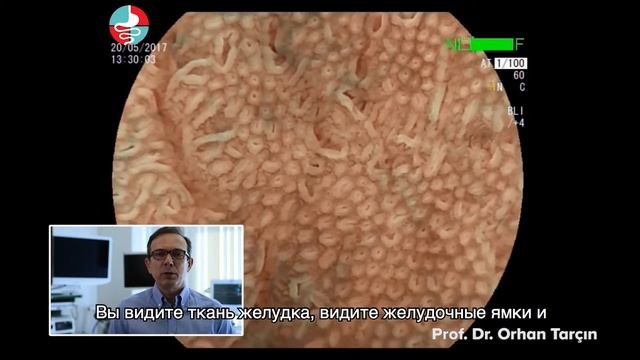 Расширенная эндоскопия-обследование желудка смотреть онлайн