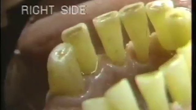 Scaling: Tissue Reaction смотреть онлайн