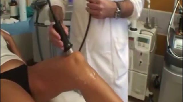 Радиолифтинг на аппарате IntraDerma Италия