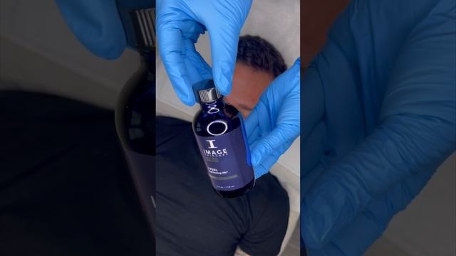 PEELS 101 - Part 4: When To Get A Peel