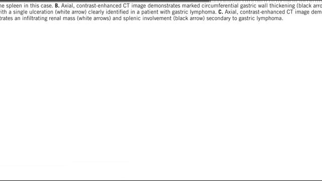 GIT MC GRAW HILL RADIOLOGY BOOKS FRCR(2) смотреть онлайн