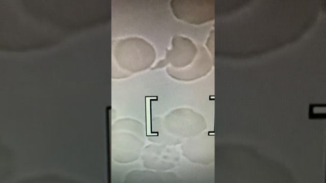 Чтобы не допустить этого, выполняйте комплекс ежедневных обязательных мероприятий. смотреть онлайн
