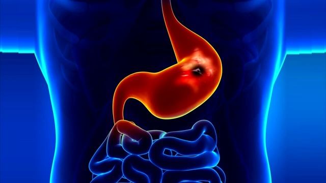 Вся правда о лечении Свеклой Вред и Польза Лечение Простуда Молочница Рак Диабет Регенерация смотреть онлайн