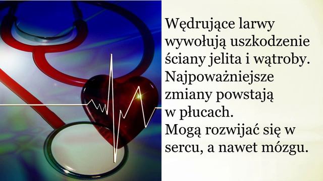 Glista ludzka - pasożyt wędrujący w ciele. Pasożyty ludzkie. cz.7 смотреть онлайн