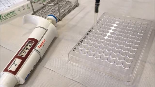 TOXOPLASMOSIS смотреть онлайн