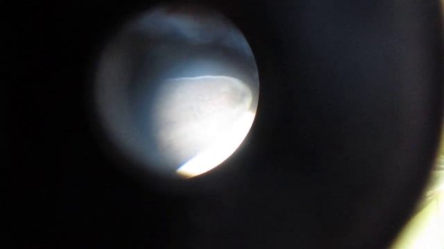 червяк под микроскопом смотреть онлайн