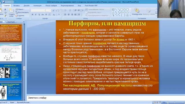 Типы наследования Синдромы и симптомы встречающиеся при различных типах наследования смотреть онлайн