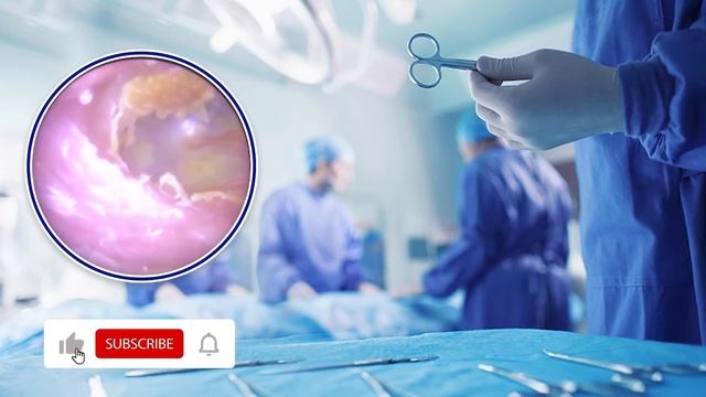 Чистка ушей, снятие сережек смотреть онлайн