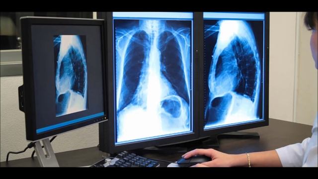 Флюорография смотреть онлайн