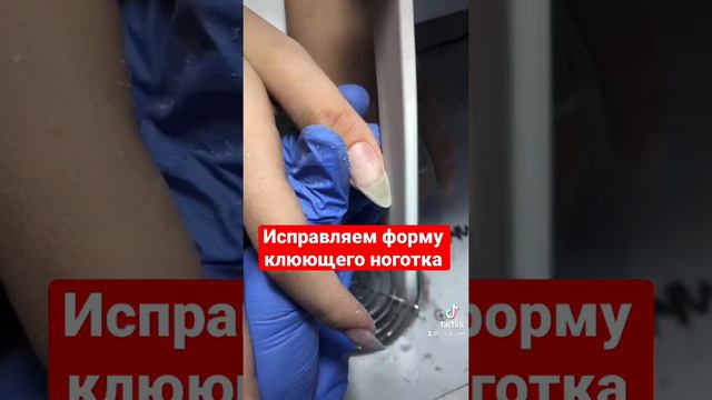 А ты исправляешь клюющие ногти? #полигель#акригель#ремонтногтя#маникюр#nails#ногти#poligel#acrigel смотреть онлайн