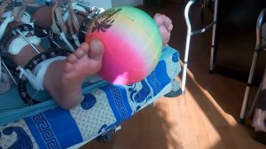 Работа с аппаратом Илизарова